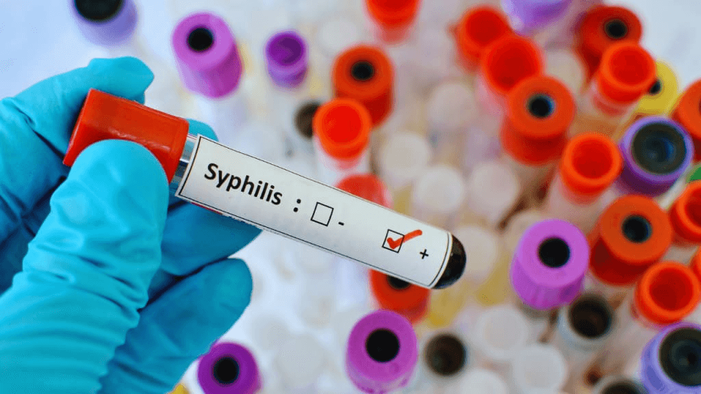 will 7 days of doxycycline cure syphilis